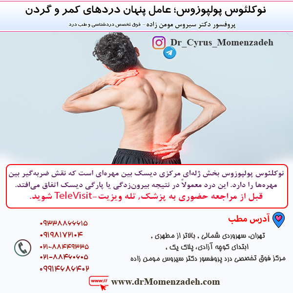 نوکلئوس پولپوزوس؛ عامل پنهان دردهای کمر و گردن