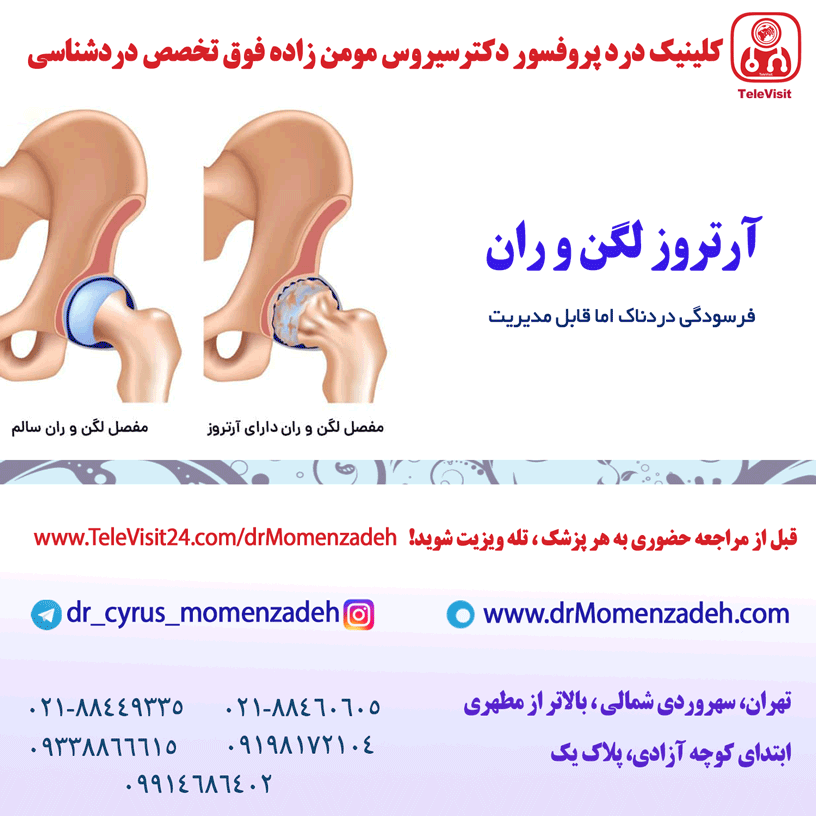 آرتروز لگن و ران