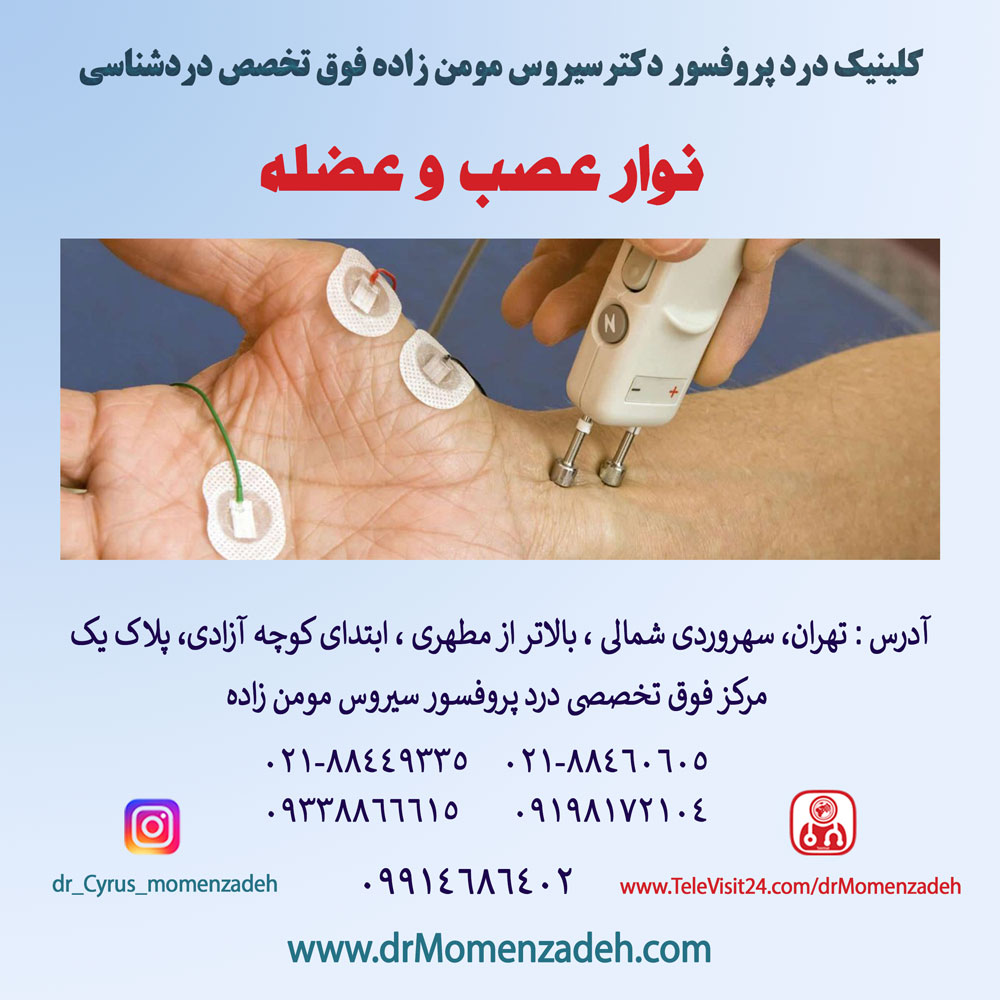 نوار عصب و عضله