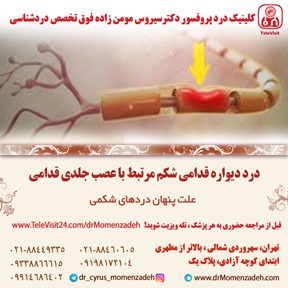 سندروم گیر افتادگی عصب جلدی قدامی (ACNES)