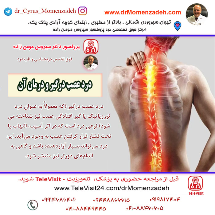 درد عصب درگیر و درمان آن