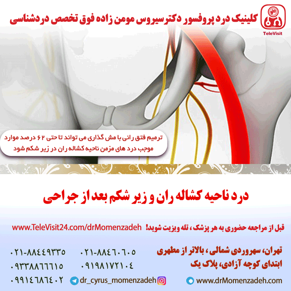 درد ناحیه کشاله ران و زیر شکم بعد از جراحی 