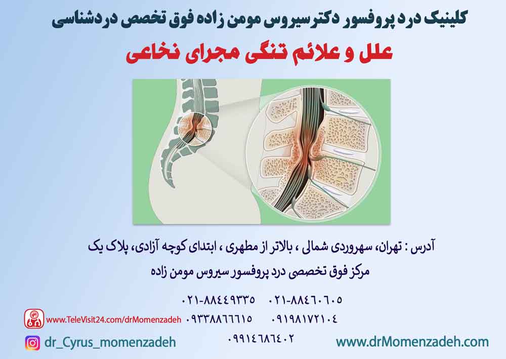 تنگی مجرای نخاعی