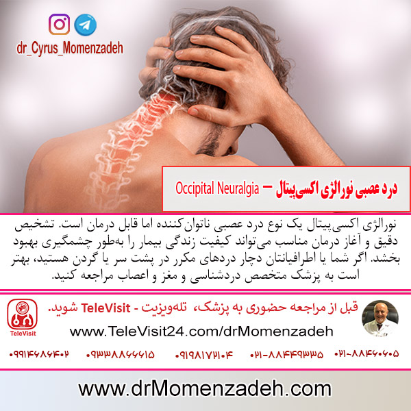 درد عصبی نورالژی اکسی‌پیتال - Occipital Neuralgia