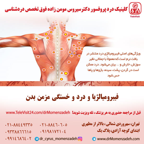 فیبرومیالژیا یا درد و خستگی مزمن کل بدن