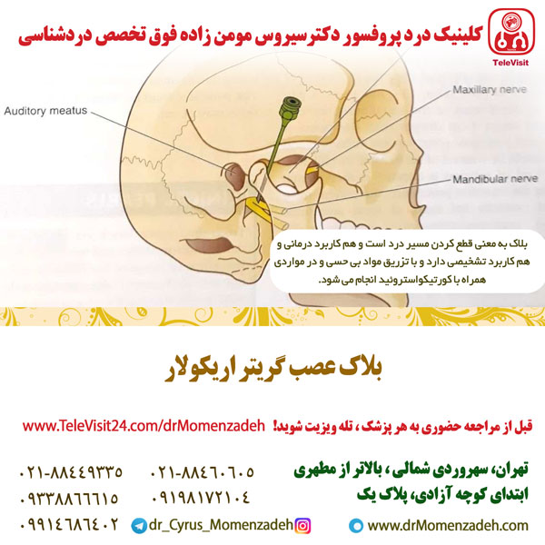عصب گریتر اریکولار