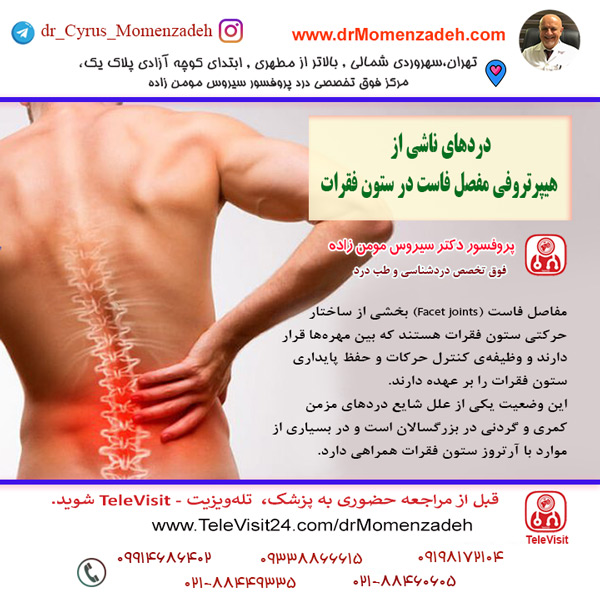 دردهای ناشی از هیپرتروفی مفصل فاست در ستون فقرات