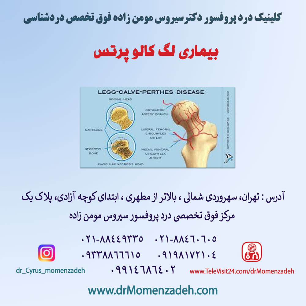 بیماری لگ کالو پرتس