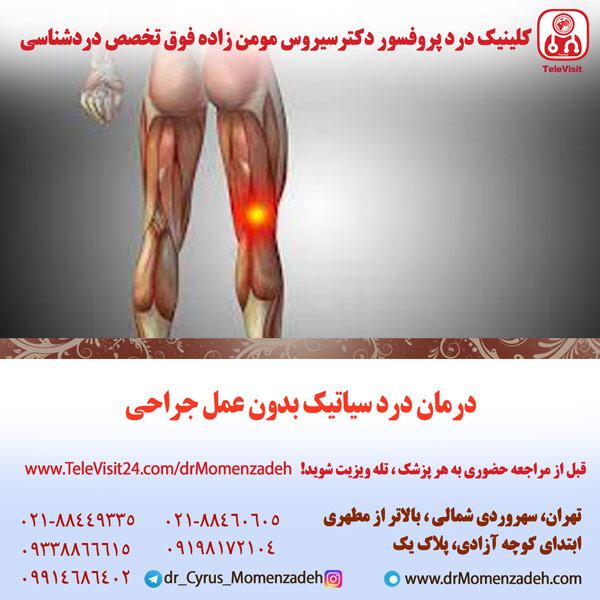 درمان درد سیاتیک بدون عمل جراحی