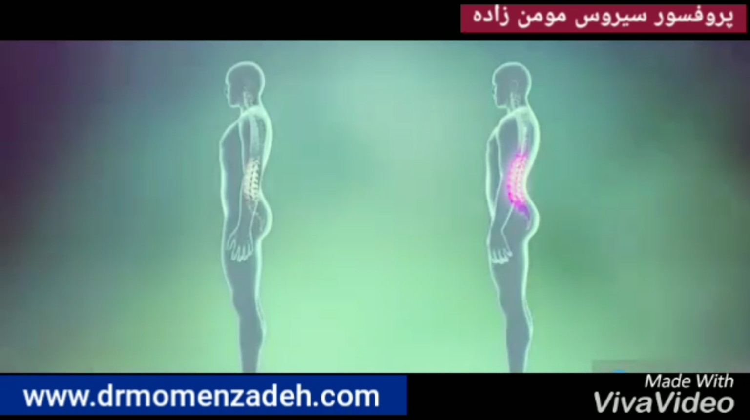 گودی کمر باعث درد شدید در ناحیه ی کمر شود!