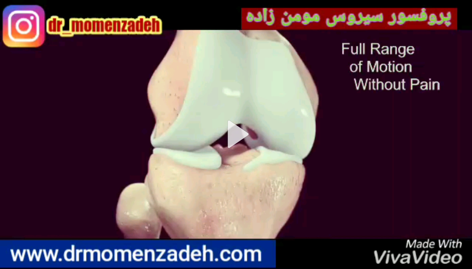 آرتروز چه بلایی سر زانوهاتون میاره؟