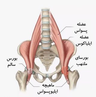 التهاب ایلیپسواس