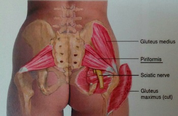 عضله پریفورمیس(Piriformis)