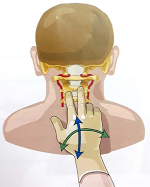مشخص کردن محل تزریق بلاک اپیدورال گردنی