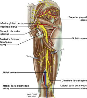 بلاک عصب سیاتیک در باسن