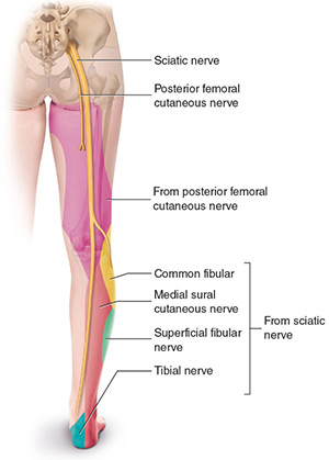 بلاک عصب سیاتیک در باسن