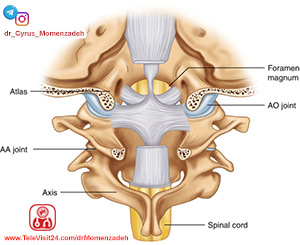 مفصل - AO joint, دکتر سیروس مومن زاده, درد, دردشناسی, فوق تخصص دردشناسی, درمان درد با لیزر, درد کمر، درد گردن, درد ستون فقرات, درد معنوی, درد روحی