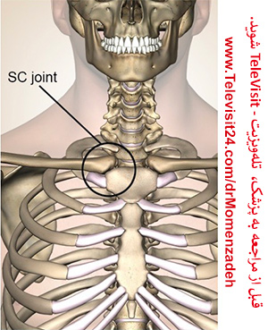 پرفسور دکتر سیروس مومن زاده, دکتر سیروس مومن زاده,پروفسور دکتر سیروس مومن زاده, درد, درمان درد,درمان درد با لیزر, لیزر درمانی,لیزر تراپی , اوزون تراپی, ازن تراپی, ازون درمانی, درد مچ دست, درد مفصل شست,  درد انگشت دست, درد جسمی, درد روحی, درد معنوی, درد بدن, درد کمر, درد پا, دردصورت, دردچانه, درد اجتماعی، درد گردن, گردن درد,درد شانه ,سر شانه, تونل کارپال, کف دست, مفصل آرنج, درد بازو, درد آرنج, درد ترقوه, مفصل استرنوکلاویکولار