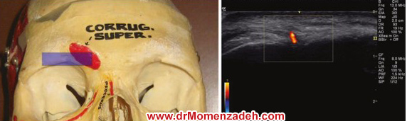 drMomenzadeh, پرفسور دکتر سیروس مومن زاده, دکتر سیروس مومن زاده,پروفسور دکتر سیروس مومن زاده, درد, درمان درد,درمان درد با لیزر, لیزر درمانی,لیزر تراپی , اوزون تراپی, ازن تراپی, ازون درمانی, درد مچ دست, درد مفصل شست,  درد انگشت دست, درد جسمی, درد روحی, درد معنوی, درد بدن, درد کمر, درد پا, دردصورت, دردچانه, درد اجتماعی، درد گردن, گردن درد,درد شانه ,سر شانه, تونل کارپال, کف دست, مفصل آرنج, درد بازو, درد آرنج, درد ترقوه, عصب سوپرا اربیتال,مغز و اعصاب