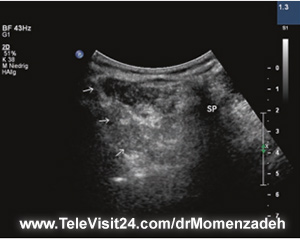 drMomenzadeh,پرفسور دکتر سیروس مومن زاده, دکتر سیروس مومن زاده,پروفسور دکتر سیروس مومن زاده, درد, درمان درد,درمان درد با لیزر, لیزر درمانی,لیزر تراپی , اوزون تراپی, ازن تراپی, ازون درمانی, درد مچ دست, درد مفصل شست,  درد انگشت دست, درد جسمی, درد روحی, درد معنوی, درد بدن, درد کمر, درد پا, دردصورت, دردچانه, درد اجتماعی، درد گردن, گردن درد,درد شانه ,سر شانه, تونل کارپال, کف دست, مفصل آرنج, درد بازو, درد آرنج, درد ترقوه, عصب سوپرا اربیتال,شبکه عصبی  کمر