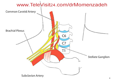 www.drMomenzadeh.com, پرفسور دکتر سیروس مومن زاده, دکتر سیروس مومن زاده,پروفسور دکتر سیروس مومن زاده, درد, درمان درد,درمان درد با لیزر, لیزر درمانی,لیزر تراپی , اوزون تراپی, ازن تراپی, ازون درمانی, درد مچ دست, درد مفصل شست,  درد انگشت دست, درد جسمی, درد روحی, درد معنوی, درد بدن, درد کمر, درد پا, دردصورت, دردچانه, درد اجتماعی، درد گردن, گردن درد,درد شانه ,سر شانه, تونل کارپال, کف دست, مفصل آرنج, درد بازو, درد آرنج, درد ترقوه, سمپاتیک گردنی