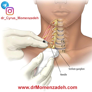 www.drMomenzadeh.com,پرفسور دکتر سیروس مومن زاده, دکتر سیروس مومن زاده,پروفسور دکتر سیروس مومن زاده, درد, درمان درد,درمان درد با لیزر, لیزر درمانی,لیزر تراپی , اوزون تراپی, ازن تراپی, ازون درمانی, درد مچ دست, درد مفصل شست,  درد انگشت دست, درد جسمی, درد روحی, درد معنوی, درد بدن, درد کمر, درد پا, دردصورت, دردچانه, درد اجتماعی، درد گردن, گردن درد,درد شانه ,سر شانه, تونل کارپال, کف دست, مفصل آرنج, درد بازو, درد آرنج, درد ترقوه, سمپاتیک گردنی