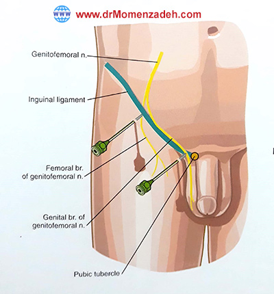 www.drMomenzadeh.com, پرفسور دکتر سیروس مومن زاده, دکتر سیروس مومن زاده,پروفسور دکتر سیروس مومن زاده, درد, درمان درد,درمان درد با لیزر, لیزر درمانی,لیزر تراپی , اوزون تراپی, ازن تراپی, ازون درمانی, درد مچ دست, درد مفصل شست,  درد انگشت دست, درد جسمی, درد روحی, درد معنوی, درد بدن, درد کمر, درد پا, دردصورت, دردچانه, درد اجتماعی، درد گردن, گردن درد,درد شانه ,سر شانه, تونل کارپال, کف دست, مفصل آرنج, درد بازو, درد آرنج, درد ترقوه, عصب سوپرا اربیتال, عصب جمینوفمورال