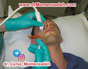 drMomenzadeh, پرفسور دکتر سیروس مومن زاده, دکتر سیروس مومن زاده,پروفسور دکتر سیروس مومن زاده, درد, درمان درد,درمان درد با لیزر, لیزر درمانی,لیزر تراپی , اوزون تراپی, ازن تراپی, ازون درمانی, درد مچ دست, درد مفصل شست,  درد انگشت دست, درد جسمی, درد روحی, درد معنوی, درد بدن, درد کمر, درد پا, دردصورت, دردچانه, درد اجتماعی، درد گردن, گردن درد,درد شانه ,سر شانه, تونل کارپال, کف دست, مفصل آرنج, درد بازو, درد آرنج, درد ترقوه, عصب سوپرا اربیتال, بلاک عصب اینفرا اربیتال