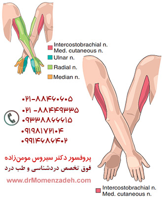 بلاک عصب مدیال کوتانوس و اینترکوستوبراکیال