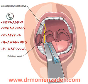 drMomenzadeh,پروفسور دکتر سیروس مومن زاده,  دکتر سیروس مومن زاده ,سیروس مومن زاده, پروفسور سیروس مومن زاده, درد شناسی, فوق تخصص, درمان درد, درد, لیزر درمانی, لیزرتراپی, ازن تراپی, اوزون درمانی, درد کمر, کمردرد, درد پا, درد گردن, گردن درد, درد دست, زانو درد, درد زانو,   مفاصل فست گردنی, ستون فقرات, آرتریت, پشت سر, ضعف سیستم ایمنی, گاید سونوگرافی,  درد حنجره, درد حنجره, درد دهان, عصب گلوسوفارنژیال