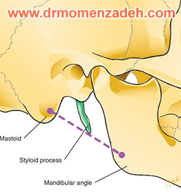 drMomenzadeh,پروفسور دکتر سیروس مومن زاده,  دکتر سیروس مومن زاده ,سیروس مومن زاده, پروفسور سیروس مومن زاده, درد شناسی, فوق تخصص, درمان درد, درد, لیزر درمانی, لیزرتراپی, ازن تراپی, اوزون درمانی, درد کمر, کمردرد, درد پا, درد گردن, گردن درد, درد دست, زانو درد, درد زانو,   مفاصل فست گردنی, ستون فقرات, آرتریت, پشت سر, ضعف سیستم ایمنی, گاید سونوگرافی,  درد حنجره, درد حنجره, درد دهان, عصب گلوسوفارنژیال, بلاک عصب واگ