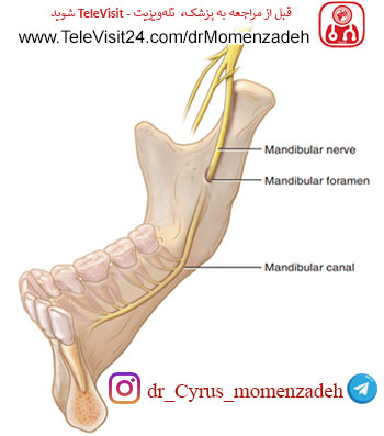 drMomenzadeh,پروفسور دکتر سیروس مومن زاده,  دکتر سیروس مومن زاده ,سیروس مومن زاده, پروفسور سیروس مومن زاده, درد شناسی, فوق تخصص, درمان درد, درد, لیزر درمانی, لیزرتراپی, ازن تراپی, اوزون درمانی, درد کمر, کمردرد, درد پا, درد گردن, گردن درد, درد دست, زانو درد, درد زانو,   مفاصل فست گردنی, ستون فقرات, آرتریت, پشت سر, ضعف سیستم ایمنی, گاید سونوگرافی,  درد حنجره, درد حنجره, درد دهان, درد بازو, بلاک شبکه بازویی, عصب اینفریور آلوئولار, عصب مندیبولار,  ,Mandibular Inferior Alveolar