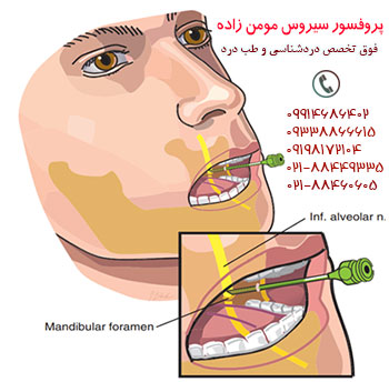 drMomenzadeh, پروفسور دکتر سیروس مومن زاده,  دکتر سیروس مومن زاده ,سیروس مومن زاده, پروفسور سیروس مومن زاده, درد شناسی, فوق تخصص, درمان درد, درد, لیزر درمانی, لیزرتراپی, ازن تراپی, اوزون درمانی, درد کمر, کمردرد, درد پا, درد گردن, گردن درد, درد دست, زانو درد, درد زانو,   مفاصل فست گردنی, ستون فقرات, آرتریت, پشت سر, ضعف سیستم ایمنی, گاید سونوگرافی,  درد حنجره, درد حنجره, درد دهان, درد بازو, بلاک شبکه بازویی, عصب اینفریور آلوئولار, عصب مندیبولار,  ,Mandibular Inferior Alveolar