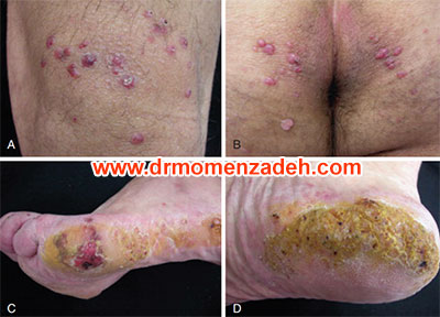 drMomenzadeh,پروفسور دکتر سیروس مومن زاده, دکتر سیروس مومن زاده ,سیروس مومن زاده, پروفسور سیروس مومن زاده, درد شناسی, فوق تخصص, درمان درد, درد, لیزر درمانی, لیزرتراپی, ازن تراپی, اوزون درمانی, درد کمر, کمردرد, درد پا, درد گردن, گردن درد, درد دست, زانو درد, درد زانو, مفاصل فست گردنی, ستون فقرات, آرتریت, پشت سر, ضعف سیستم ایمنی, گاید سونوگرافی, درد حنجره, درد حنجره, درد دهان, درد بازو, بلاک شبکه بازویی, فست گردن, درد کنار گردن تا قفسه سینه, اعصاب نخاعی گردنی, بلاک عصب فرنیک, Phrenic