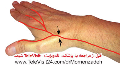 drMomenzadeh, پروفسور دکتر سیروس مومن زاده,  دکتر سیروس مومن زاده ,سیروس مومن زاده, پروفسور سیروس مومن زاده, درد شناسی, فوق تخصص, درمان درد, درد, لیزر درمانی, لیزرتراپی, ازن تراپی, اوزون درمانی, درد کمر, کمردرد, درد پا, درد گردن, گردن درد, درد دست, زانو درد, درد زانو, مفاصل فست گردنی, ستون فقرات, آرتریت, پشت سر, ضعف سیستم ایمنی, گاید سونوگرافی,  درد حنجره, درد حنجره, درد دهان, درد بازو, بلاک شبکه بازویی, فست گردن, درد کنار گردن تا قفسه سینه, نوریت بازویی, مچ دست