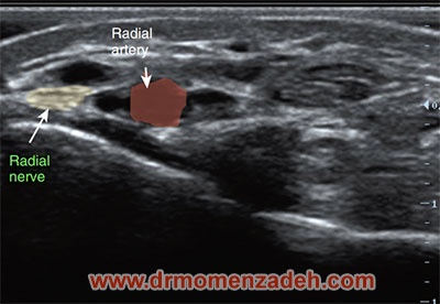 drMomenzadeh, پروفسور دکتر سیروس مومن زاده,  دکتر سیروس مومن زاده ,سیروس مومن زاده, پروفسور سیروس مومن زاده, درد شناسی, فوق تخصص, درمان درد, درد, لیزر درمانی, لیزرتراپی, ازن تراپی, اوزون درمانی, درد کمر, کمردرد, درد پا, درد گردن, گردن درد, درد دست, زانو درد, درد زانو, مفاصل فست گردنی, ستون فقرات, آرتریت, پشت سر, ضعف سیستم ایمنی, گاید سونوگرافی,  درد حنجره, درد حنجره, درد دهان, درد بازو, بلاک شبکه بازویی, فست گردن, درد کنار گردن تا قفسه سینه, نوریت بازویی, مچ دست