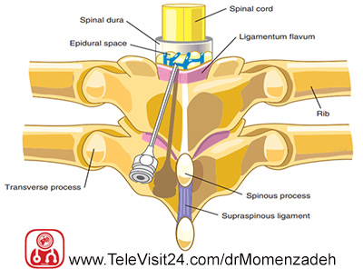 drMomenzadeh