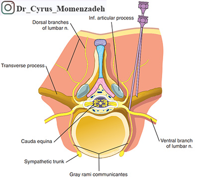 drCyrusMomenzadeh, کمردرد, درد کمر, گردن درد, درد گردن, درد ستون فقرات, پا درد, درد پا, دردشناسی, لیزر درمانی, لیزرتراپی, استخوان درد, کلینیک درد, بهترین کلینیک درد در تهران, بهترین دکتر دیسک کمر, کلینیک درد غرب تهران, کلینیک درد دولتی, کلینیک درد در جنوب تهران, کلینیک درد تهران, کلینیک درد فوق تخصصی, خدمات کلینیک درد, دکتر مومن زاده, فوق تخصص درد