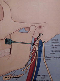 drCyrusMomenzadeh