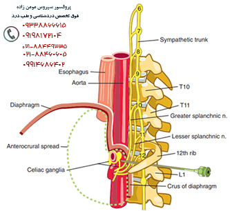 drCyrusMomenzadeh, کلینیک درد, بهترین کلینیک درد در تهران, بهترین دکتر دیسک کمر, کلینیک درد غرب تهران, کلینیک درد دولتی, کلینیک درد در جنوب تهران, کلینیک درد تهران, کلینیک درد فوق تخصصی, خدمات کلینیک درد, دکتر مومن زاده فوق تخصص