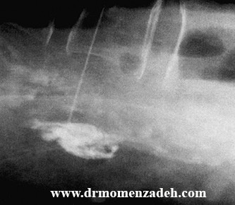 drCyrusMomenzadeh, کلینیک درد, بهترین کلینیک درد در تهران, بهترین دکتر دیسک کمر, کلینیک درد غرب تهران, کلینیک درد دولتی, کلینیک درد در جنوب تهران, کلینیک درد تهران, کلینیک درد فوق تخصصی, خدمات کلینیک درد, دکتر مومن زاده فوق تخصص