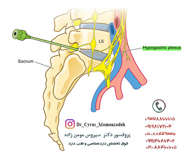 drCyrusMomenzadeh