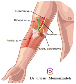 عصب مدین