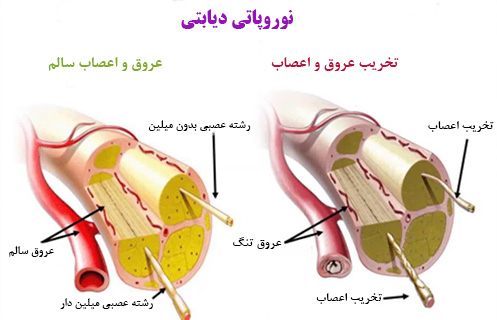 drCyrusMomenzadeh