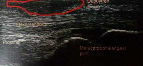 drCyrusMomenzadeh